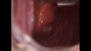 Avy Open Pussy uban sa Speculum